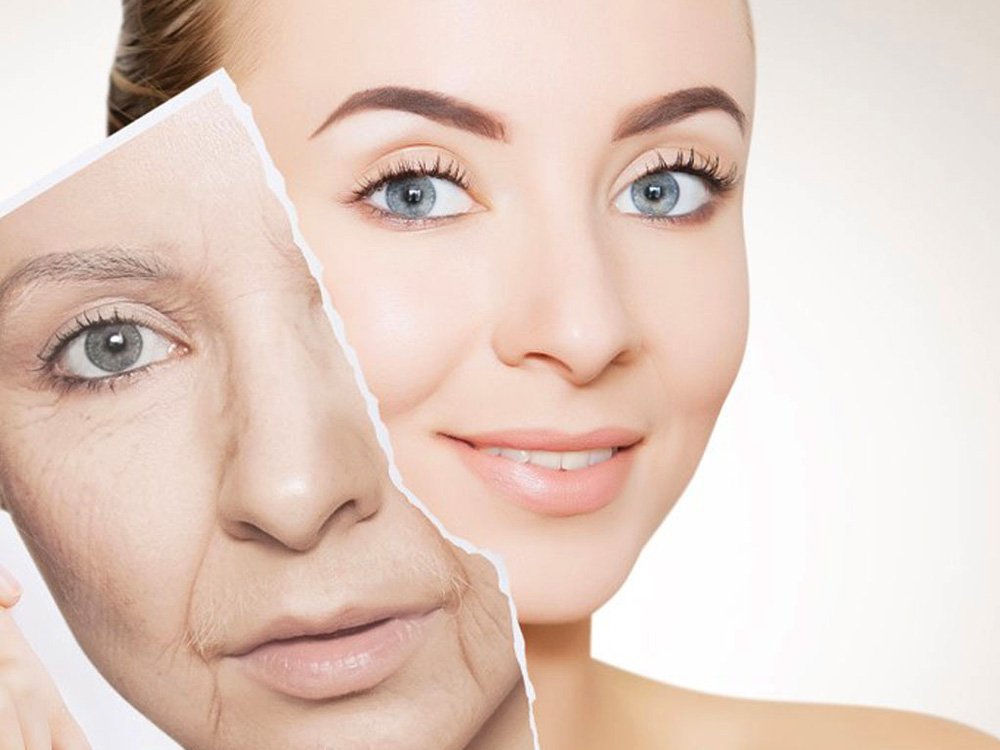 Anti-aging